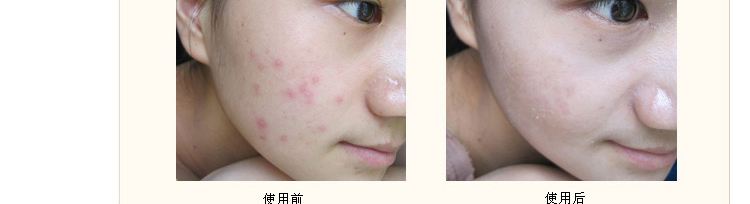 海口耳再造去哪家整形医院好