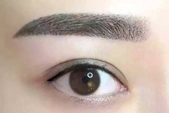 腋下激光脱毛多少钱左右呢?