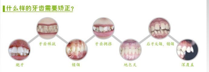 打了玻尿酸之后多久可以敷面膜