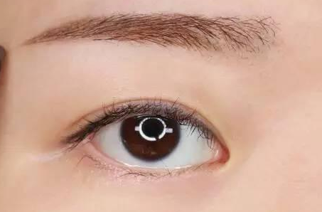 切眉手术后多久结痂