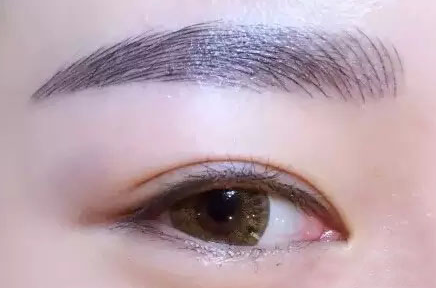 韩式无痕开眼角大概怎么做多少钱