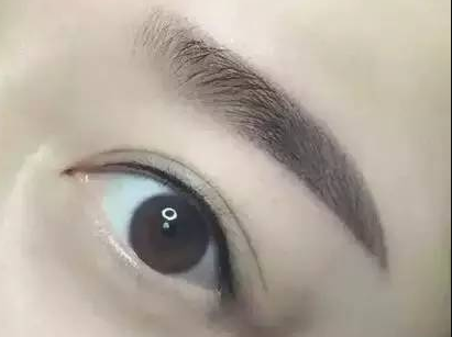 手术去抬头纹有疤痕吗