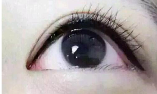 腹部抽脂过程是怎么样的呢