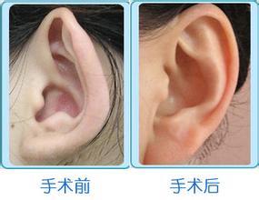 玻尿酸丰唇珠痛吗?