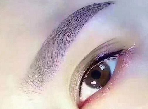 去鱼尾纹最有效的方法有哪些