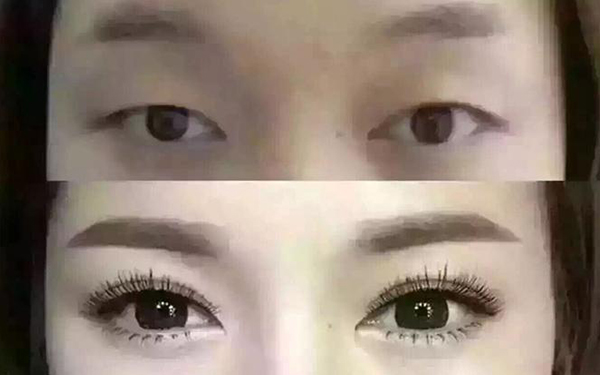 来月经的时候可以做美容吗
