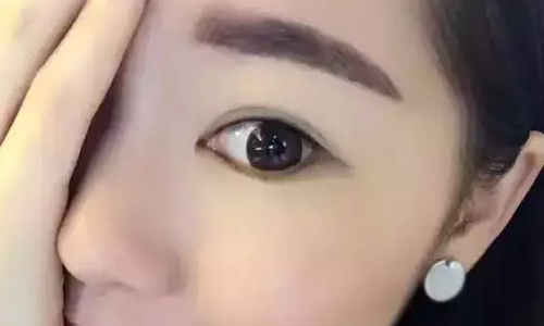 皮肤缝合法鼻小柱延长有什么危险啊