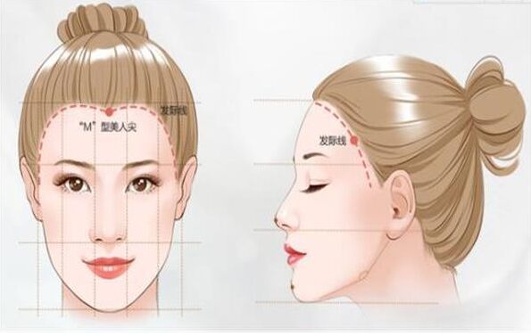 去痘印痘坑的术后要什么