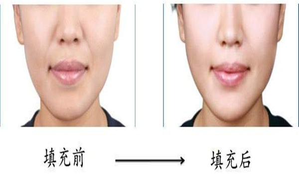 韩式纹眉多少钱贵不贵