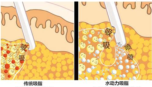 割双眼皮多久能吃牛肉