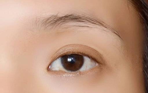 整容垫鼻子后能吃消炎药吗?