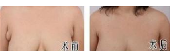 怎么才会瘦肚子
