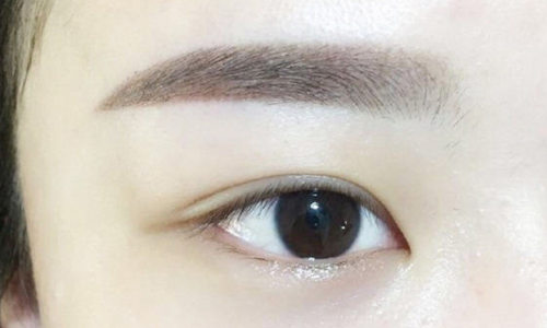 如何正确有效的治疗酒糟鼻
