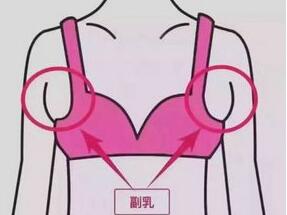 做腹部抽脂术后如何护理