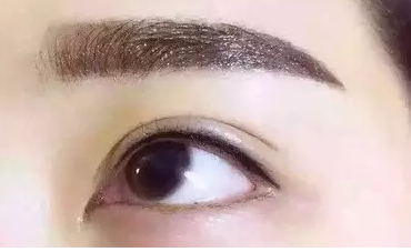 阴部脱毛要多少钱