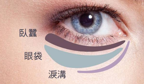 整颧骨和丰太阳穴痛苦吗
