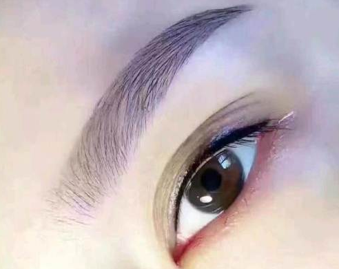 自体脂肪填充额头多久能运动