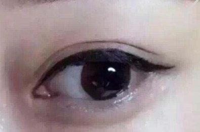 美白祛痘的方法
