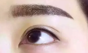 有什么方法可以去黑眼圈?