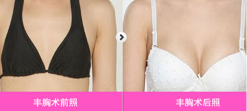 韩式纹眉术后风险并发症有哪些