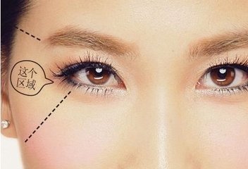 假体隆胸乳房整形手术后需要注意什么?