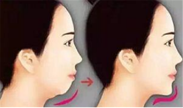 美容冠是什么?有危害吗?