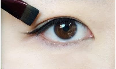 做自体脂肪隆眉弓结痂几天