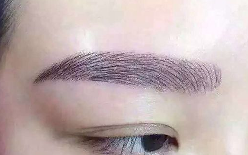 做韩式开眼角效果如何