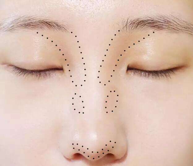 光纤溶脂瘦脸价格贵吗