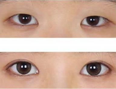 怎样瘦肚子和屁股