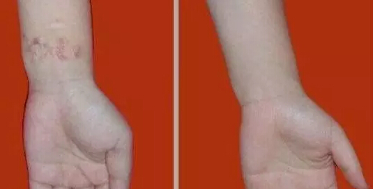 牙齿美白牙贴多少钱